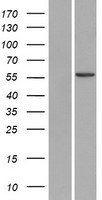 USP30 Protein - Western validation with an anti-DDK antibody * L: Control HEK293 lysate R: Over-expression lysate