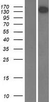 USP31 Protein - Western validation with an anti-DDK antibody * L: Control HEK293 lysate R: Over-expression lysate