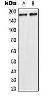 USP32 Antibody - Western blot analysis of USP32 expression in HeLa (A); NIH3T3 (B) whole cell lysates.