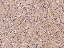 USP32 Antibody - Immunochemical staining of human USP32 in human liver with rabbit polyclonal antibody at 1:100 dilution, formalin-fixed paraffin embedded sections.