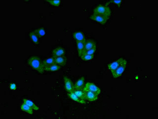 USP33 / VDU1 Antibody - Immunofluorescent analysis of HepG2 cells using USP33 Antibody at dilution of 1:100 and Alexa Fluor 488-congugated AffiniPure Goat Anti-Rabbit IgG(H+L)