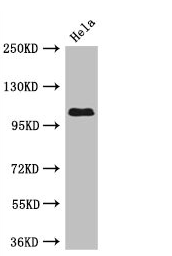 USP33 / VDU1 Antibody - Western Blot Positive WB detected in: Hela whole cell lysate All lanes: USP33 antibody at 3µg/ml Secondary Goat polyclonal to rabbit IgG at 1/50000 dilution Predicted band size: 107, 104, 94 kDa Observed band size: 107 kDa