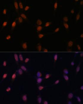 USP33 / VDU1 Antibody - Immunofluorescence analysis of NIH/3T3 cells using USP33 Polyclonal Antibody at dilution of 1:100 (40x lens).Blue: DAPI for nuclear staining.