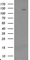 USP36 Antibody - HEK293T cells were transfected with the pCMV6-ENTRY control (Left lane) or pCMV6-ENTRY USP36 (Right lane) cDNA for 48 hrs and lysed. Equivalent amounts of cell lysates (5 ug per lane) were separated by SDS-PAGE and immunoblotted with anti-USP36.