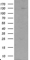 USP36 Antibody - HEK293T cells were transfected with the pCMV6-ENTRY control (Left lane) or pCMV6-ENTRY USP36 (Right lane) cDNA for 48 hrs and lysed. Equivalent amounts of cell lysates (5 ug per lane) were separated by SDS-PAGE and immunoblotted with anti-USP36.