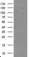 USP36 Antibody - HEK293T cells were transfected with the pCMV6-ENTRY control (Left lane) or pCMV6-ENTRY USP36 (Right lane) cDNA for 48 hrs and lysed. Equivalent amounts of cell lysates (5 ug per lane) were separated by SDS-PAGE and immunoblotted with anti-USP36.