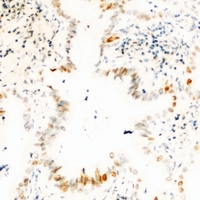 USP36 Antibody - Immunohistochemical analysis of USP36 staining in human kidney formalin fixed paraffin embedded tissue section. The section was pre-treated using heat mediated antigen retrieval with sodium citrate buffer (pH 6.0). The section was then incubated with the antibody at room temperature and detected with HRP and DAB as chromogen. The section was then counterstained with hematoxylin and mounted with DPX.