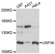 USP36 Antibody - Western blot analysis of extracts of various cell lines, using USP36 antibody at 1:3000 dilution. The secondary antibody used was an HRP Goat Anti-Rabbit IgG (H+L) at 1:10000 dilution. Lysates were loaded 25ug per lane and 3% nonfat dry milk in TBST was used for blocking. An ECL Kit was used for detection and the exposure time was 15s.