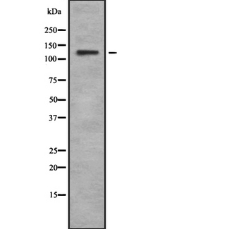 USP36 Antibody - Western blot analysis USP36 using HuvEc whole cells lysates