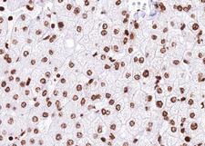 USP36 Antibody - 1:100 staining human liver tissue by IHC-P. The tissue was formaldehyde fixed and a heat mediated antigen retrieval step in citrate buffer was performed. The tissue was then blocked and incubated with the antibody for 1.5 hours at 22°C. An HRP conjugated goat anti-rabbit antibody was used as the secondary.