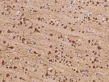 USP36 Antibody - Immunochemical staining of human USP36 in human brain with rabbit polyclonal antibody at 1:100 dilution, formalin-fixed paraffin embedded sections.