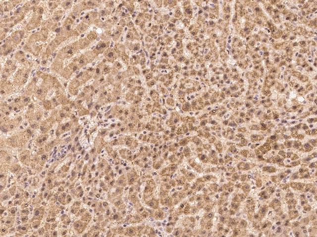 USP36 Antibody - Immunochemical staining of human USP36 in human liver with rabbit polyclonal antibody at 1:100 dilution, formalin-fixed paraffin embedded sections.
