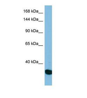 USP36 Antibody - Western blot of Human HepG2. USP36 antibody dilution 1.0 ug/ml.  This image was taken for the unconjugated form of this product. Other forms have not been tested.