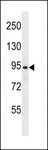 USP37 Antibody - UBP37 Antibody western blot of HL-60 cell line lysates (35 ug/lane). The UBP37 antibody detected the UBP37 protein (arrow).