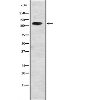 USP37 Antibody - Western blot analysis of USP37 expression in HeLa cells lysate. The lane on the left is treated with the antigen-specific peptide.
