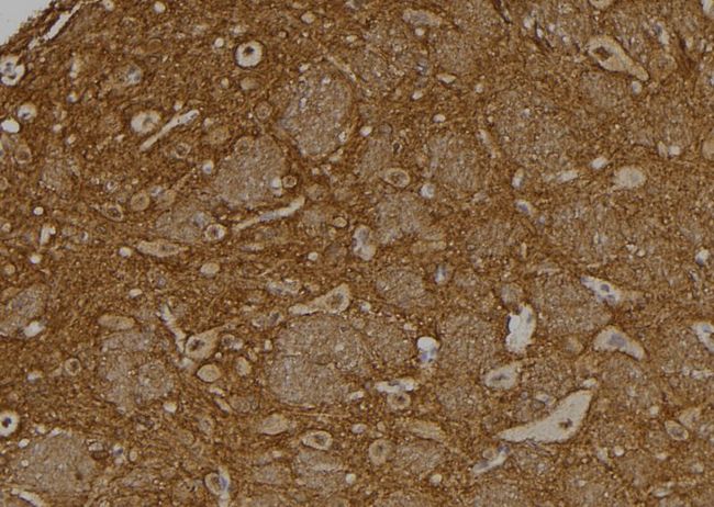 USP37 Antibody - 1:100 staining rat brain tissue by IHC-P. The sample was formaldehyde fixed and a heat mediated antigen retrieval step in citrate buffer was performed. The sample was then blocked and incubated with the antibody for 1.5 hours at 22°C. An HRP conjugated goat anti-rabbit antibody was used as the secondary.