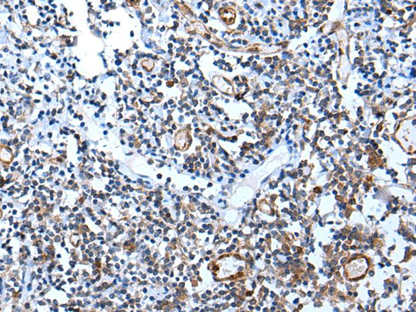 USP37 Antibody - Immunohistochemistry of paraffin-embedded Human tonsil tissue  using USP37 Polyclonal Antibody at dilution of 1:45(×200)