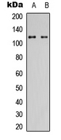 USP38 Antibody - Western blot analysis of USP38 expression in HeLa (A); mouse brain (B) whole cell lysates.