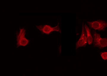 USP38 Antibody - Staining 293 cells by IF/ICC. The samples were fixed with PFA and permeabilized in 0.1% Triton X-100, then blocked in 10% serum for 45 min at 25°C. The primary antibody was diluted at 1:200 and incubated with the sample for 1 hour at 37°C. An Alexa Fluor 594 conjugated goat anti-rabbit IgG (H+L) Ab, diluted at 1/600, was used as the secondary antibody.