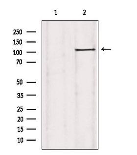 USP38 Antibody - Western blot analysis of extracts of rat heart tissue using USP38 antibody. Lane 1 was treated with the blocking peptide.