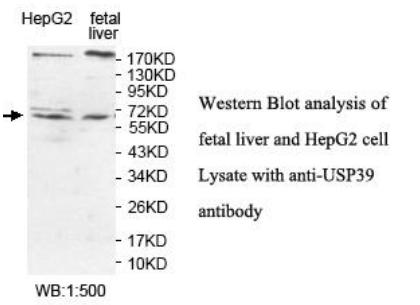 USP39 Antibody - Western blot of USP39 antibody