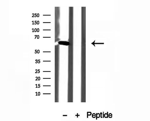 USP39 Antibody - Western blot analysis of extracts of HepG2 cells using USP39 antibody.