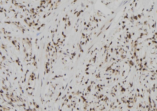 USP39 Antibody - 1:100 staining human gastric tissue by IHC-P. The sample was formaldehyde fixed and a heat mediated antigen retrieval step in citrate buffer was performed. The sample was then blocked and incubated with the antibody for 1.5 hours at 22°C. An HRP conjugated goat anti-rabbit antibody was used as the secondary.