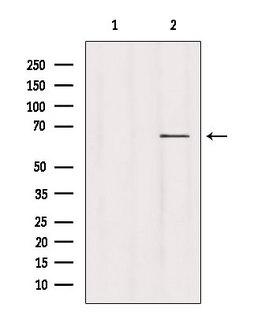 USP39 Antibody - Western blot analysis of extracts of HepG2 cells using USP39 antibody. Lane 1 was treated with the blocking peptide.