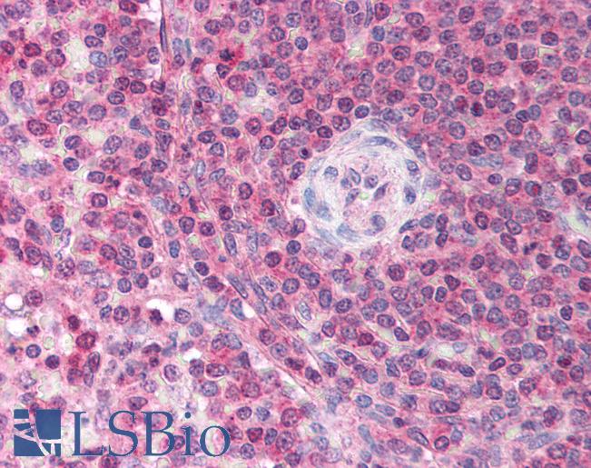 USP39 Antibody - Anti-USP39 antibody IHC of human spleen. Immunohistochemistry of formalin-fixed, paraffin-embedded tissue after heat-induced antigen retrieval. Antibody concentration 5 ug/ml.  This image was taken for the unconjugated form of this product. Other forms have not been tested.