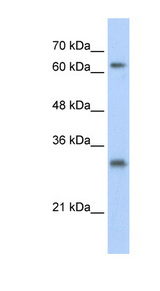 USP39 Antibody - USP39 antibody Western blot of HepG2 cell lysate. This image was taken for the unconjugated form of this product. Other forms have not been tested.