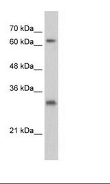 USP39 Antibody - HepG2 Cell Lysate.  This image was taken for the unconjugated form of this product. Other forms have not been tested.