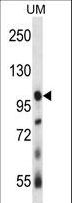USP4 Antibody - USP4 Antibody western blot of human uterine tumor tissue lysates (35 ug/lane). The USP4 antibody detected the USP4 protein (arrow).