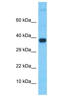 USP4 Antibody - UNP / USP4 antibody Western Blot of Fetal Liver. Antibody dilution: 1 ug/ml.  This image was taken for the unconjugated form of this product. Other forms have not been tested.