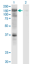 USP4 Antibody - Western Blot analysis of USP4 expression in transfected 293T cell line by USP4 monoclonal antibody (M01), clone 5E12.Lane 1: USP4 transfected lysate (Predicted MW: 108.6 KDa).Lane 2: Non-transfected lysate.