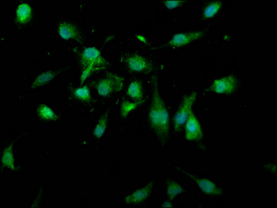 USP4 Antibody - Immunofluorescence staining of U251 cells at a dilution of 1:166, counter-stained with DAPI. The cells were fixed in 4% formaldehyde, permeabilized using 0.2% Triton X-100 and blocked in 10% normal Goat Serum. The cells were then incubated with the antibody overnight at 4°C.The secondary antibody was Alexa Fluor 488-congugated AffiniPure Goat Anti-Rabbit IgG (H+L) .
