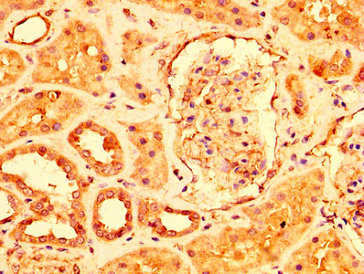USP4 Antibody - Immunohistochemistry image at a dilution of 1:500 and staining in paraffin-embedded human kidney tissue performed on a Leica BondTM system. After dewaxing and hydration, antigen retrieval was mediated by high pressure in a citrate buffer (pH 6.0) . Section was blocked with 10% normal goat serum 30min at RT. Then primary antibody (1% BSA) was incubated at 4 °C overnight. The primary is detected by a biotinylated secondary antibody and visualized using an HRP conjugated SP system.