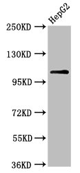 USP4 Antibody - Positive Western Blot detected in HepG2 whole cell lysate. All lanes: USP4 antibody at 6.3 µg/ml Secondary Goat polyclonal to rabbit IgG at 1/50000 dilution. Predicted band size: 109, 104, 36 KDa. Observed band size: 109 KDa