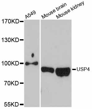 USP4 Antibody - Western blot analysis of extracts of various cell lines, using USP4 antibody at 1:3000 dilution. The secondary antibody used was an HRP Goat Anti-Rabbit IgG (H+L) at 1:10000 dilution. Lysates were loaded 25ug per lane and 3% nonfat dry milk in TBST was used for blocking. An ECL Kit was used for detection and the exposure time was 90s.