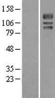 USP4 Protein - Western validation with an anti-DDK antibody * L: Control HEK293 lysate R: Over-expression lysate