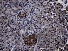 USP40 Antibody - Immunohistochemical staining of paraffin-embedded Human pancreas tissue within the normal limits using anti-USP40 mouse monoclonal antibody. (Heat-induced epitope retrieval by 1mM EDTA in 10mM Tris buffer. (pH8.5) at 120°C for 3 min. (1:500)