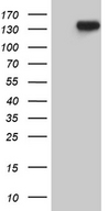 USP40 Antibody - HEK293T cells were transfected with the pCMV6-ENTRY control. (Left lane) or pCMV6-ENTRY USP40. (Right lane) cDNA for 48 hrs and lysed. Equivalent amounts of cell lysates. (5 ug per lane) were separated by SDS-PAGE and immunoblotted with anti-USP40. (1:2000)
