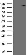 USP40 Antibody - HEK293T cells were transfected with the pCMV6-ENTRY control. (Left lane) or pCMV6-ENTRY USP40. (Right lane) cDNA for 48 hrs and lysed. Equivalent amounts of cell lysates. (5 ug per lane) were separated by SDS-PAGE and immunoblotted with anti-USP40. (1:2000)