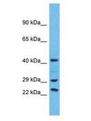 USP41 Antibody - USP41 antibody Western Blot of HeLa. Antibody dilution: 1 ug/ml.  This image was taken for the unconjugated form of this product. Other forms have not been tested.