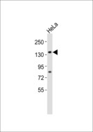 USP42 Antibody - Anti-USP42 Antibody at 1:1000 dilution + HeLa whole cell lysates Lysates/proteins at 20 ug per lane. Secondary Goat Anti-Rabbit IgG, (H+L),Peroxidase conjugated at 1/10000 dilution Predicted band size : 145 kDa Blocking/Dilution buffer: 5% NFDM/TBST.