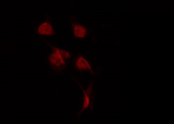 USP42 Antibody - Staining LOVO cells by IF/ICC. The samples were fixed with PFA and permeabilized in 0.1% Triton X-100, then blocked in 10% serum for 45 min at 25°C. The primary antibody was diluted at 1:200 and incubated with the sample for 1 hour at 37°C. An Alexa Fluor 594 conjugated goat anti-rabbit IgG (H+L) Ab, diluted at 1/600, was used as the secondary antibody.