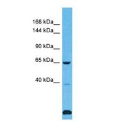 USP43 Antibody - Western blot of Human Fetal Lung. USP43 antibody dilution 1.0 ug/ml.  This image was taken for the unconjugated form of this product. Other forms have not been tested.