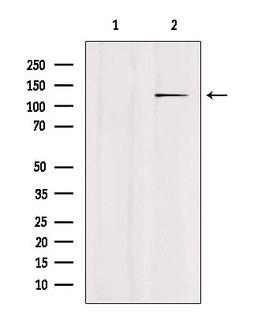 USP43 Antibody - Western blot analysis of extracts of mouse brain tissue using USP43 antibody. Lane 1 was treated with the blocking peptide.