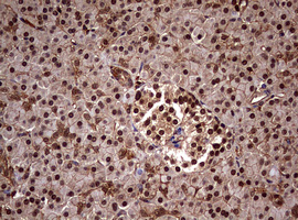 USP44 Antibody - IHC of paraffin-embedded Human pancreas tissue using anti-USP44 mouse monoclonal antibody. (Heat-induced epitope retrieval by 10mM citric buffer, pH6.0, 120°C for 3min).
