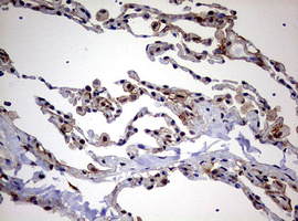 USP44 Antibody - IHC of paraffin-embedded Human lung tissue using anti-USP44 mouse monoclonal antibody. (Heat-induced epitope retrieval by 10mM citric buffer, pH6.0, 120°C for 3min).