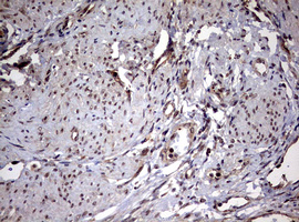 USP44 Antibody - IHC of paraffin-embedded Human endometrium tissue using anti-USP44 mouse monoclonal antibody. (Heat-induced epitope retrieval by 10mM citric buffer, pH6.0, 120°C for 3min).